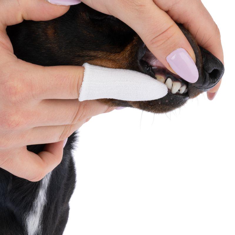 360° dental finger cover